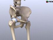Hip Anatomy