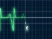 ECG Heartrate Graph Animation