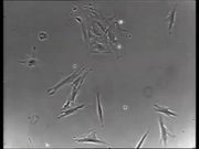 Normal vs Cancer Cells