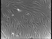 Normal vs Cancer Cells