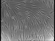 Normal vs Cancer Cells