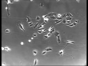 Normal vs Cancer Cells