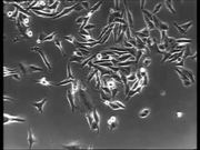 Normal vs Cancer Cells