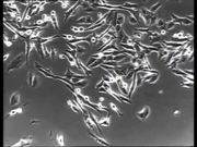 Normal vs Cancer Cells