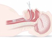 NeuroSave Technology Overview