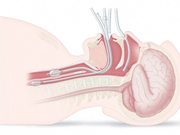 NeuroSave Technology Overview